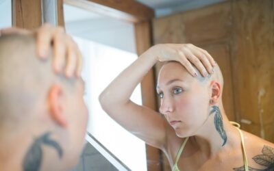 Homeopathy for Managing Treatment-Induced Hair Loss in Cancer Patients